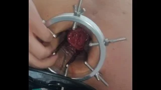 打开了我的肛门破坏他